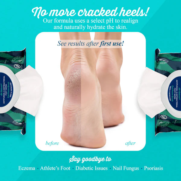 pHeet Antifungal & Antibacterial Foot Wipes