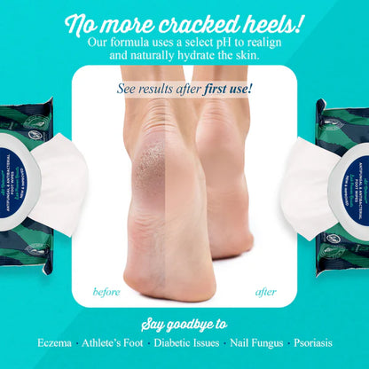 pHeet Antifungal & Antibacterial Foot Wipes